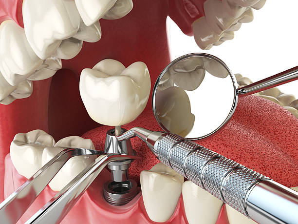 Best Emergency Dental Care for Trauma or Injury in Madeira, OH